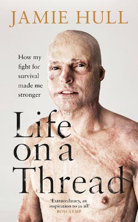 Cover: Life on a Thread